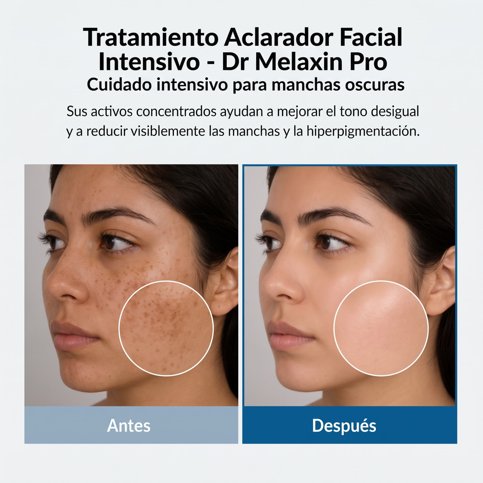 Cuidado intensivo para manchas oscuras